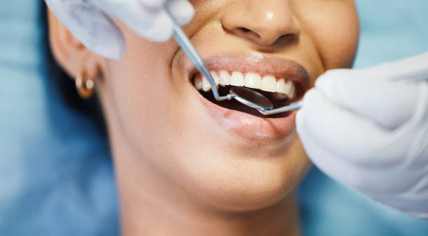 Best Dentist for Tooth Abscess  in Balcones Heights, TX